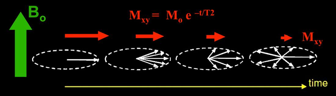 t2-spin-spin-relaxation-questions-and-answers-in-mri