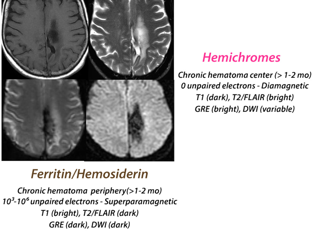 Mri blood weighted t1 MRI sequences