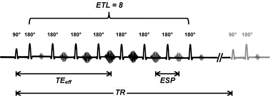 Turbo spin-echo. Turbo spin-echo or Fast spin-echo sequence.