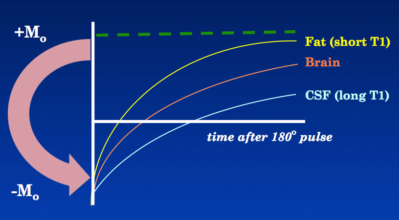 What Is Inversion Recovery In Mri