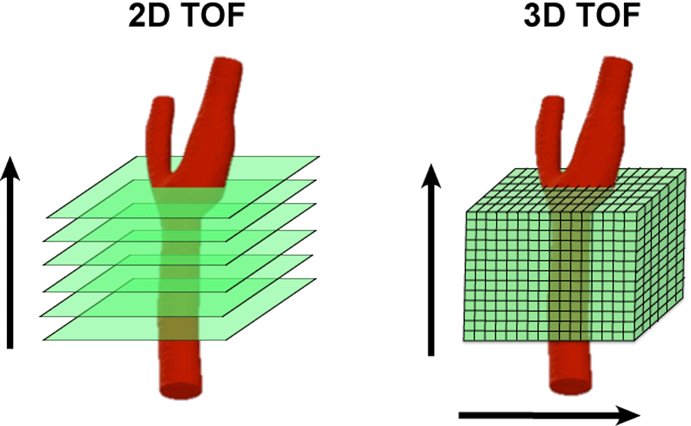 2d Vs 3d Mra Questions And Answers In Mri