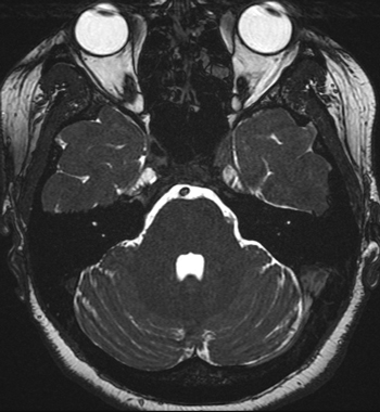 Fiesta C Questions And Answers In Mri