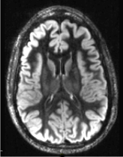 Double IR Questions and Answers in MRI