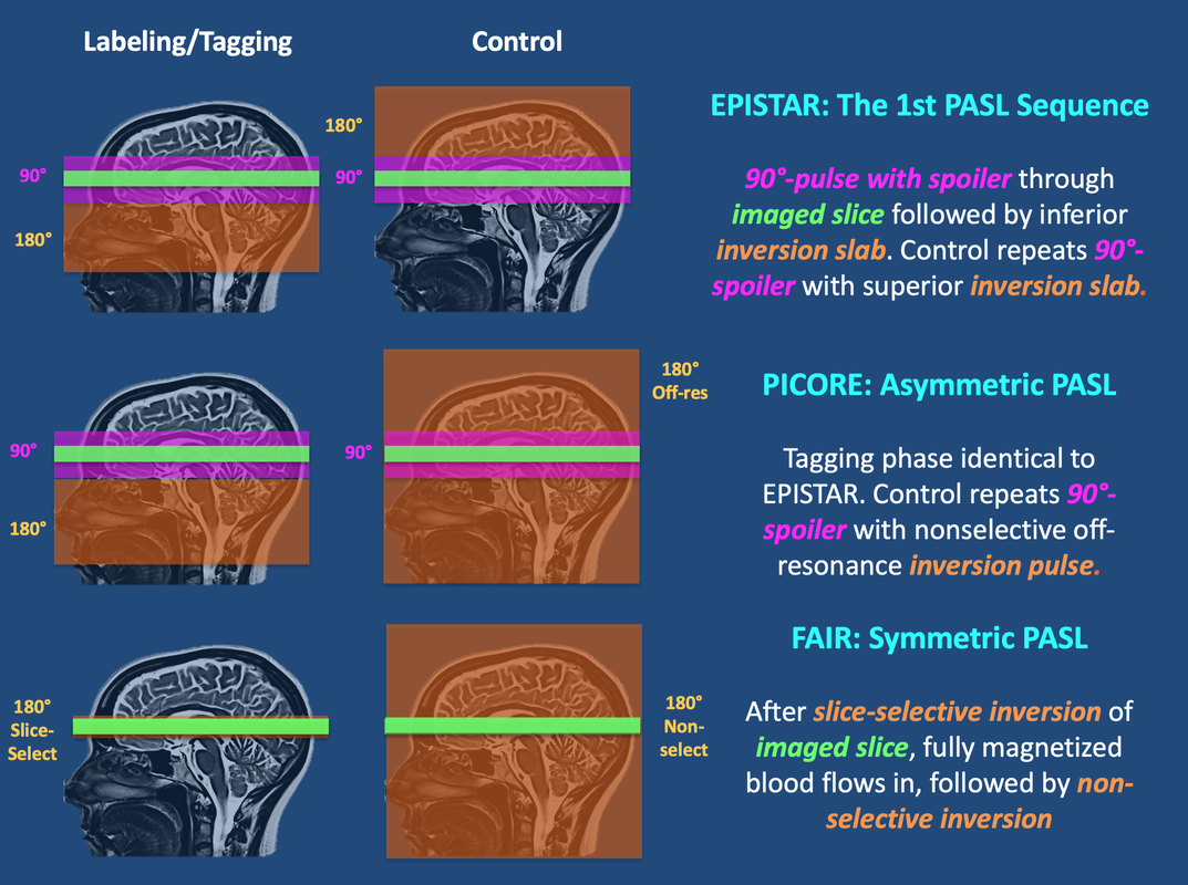 PASL - Questions and Answers ​in MRI