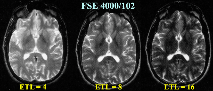 TSE/FSE - Questions and Answers ​in MRI