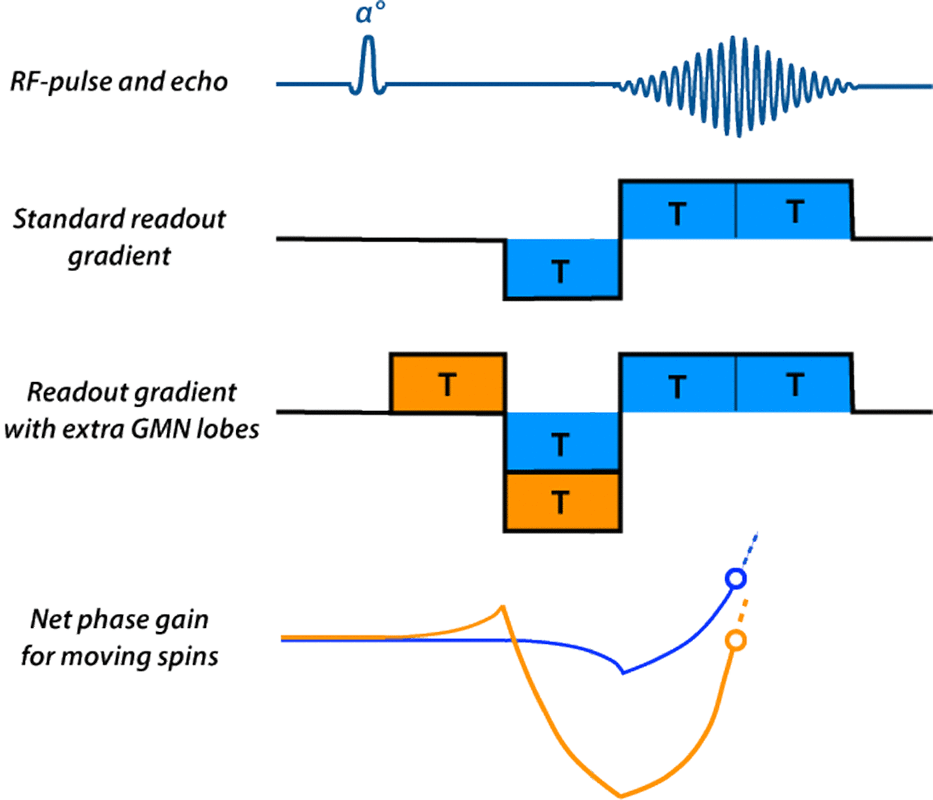 Gradient-moment nulling or flow-compensation