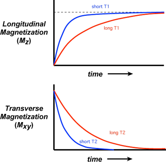 T1 and T2 effects - Questions and Answers in MRI