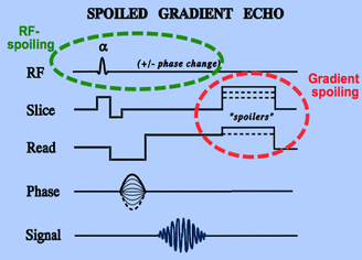 Spoiled gradient echo pulse sequence MR