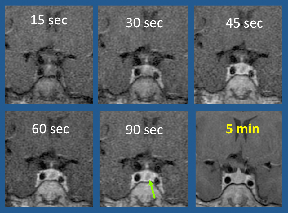 Dynamic CE imaging - Questions and Answers ​in MRI