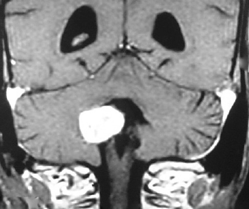 detaljer Mindst Dental Gadolinium - Questions and Answers ​in MRI