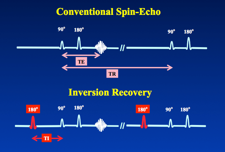 Inversion Recovery (IR) Sequence