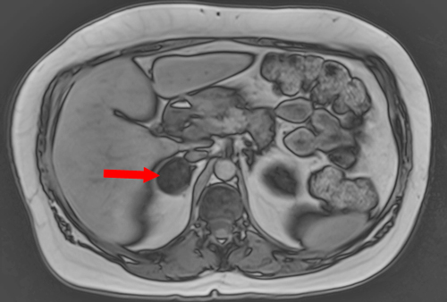 In Phase out Of Phase Questions And Answers In MRI