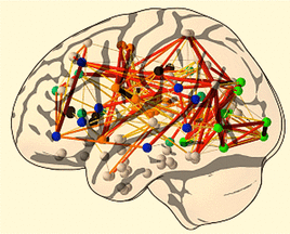 brain network graph