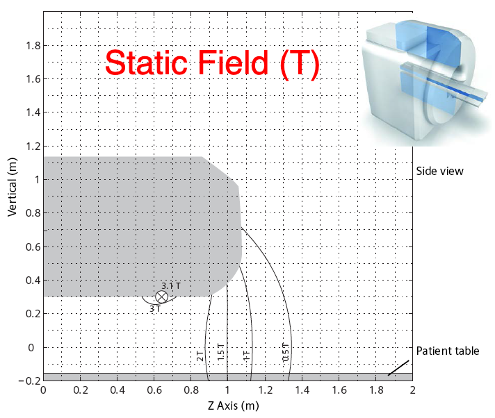 Spatial gradient field - Questions and Answers ​in MRI