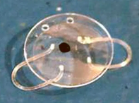 Worst lens implant