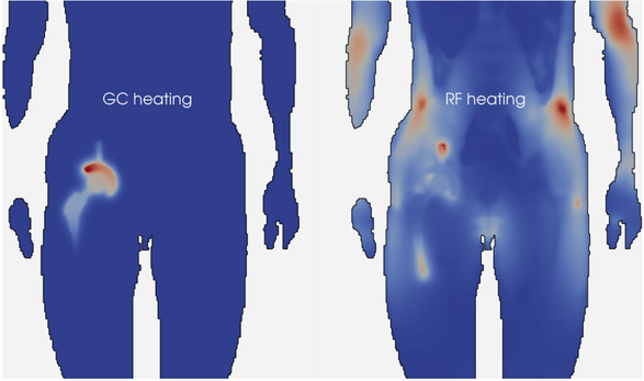 Gradient vs RF heating anatomy