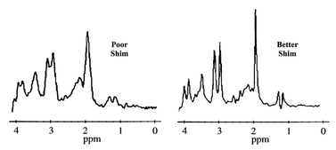 Effect of shimming on MR spectra